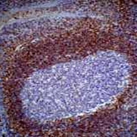 BCL2 Mouse Monoclonal Antibody