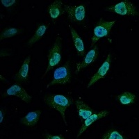 BCL2 Mouse Monoclonal Antibody