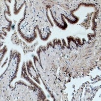 CD16 Mouse Monoclonal Antibody