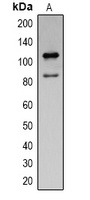 Cleaved PARP1 Mouse Monoclonal Antibody