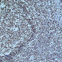 Cleaved PARP1 Mouse Monoclonal Antibody