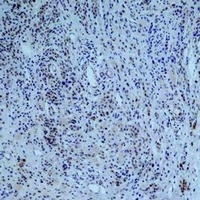 Collagen 3 alpha 1 Mouse Monoclonal Antibody