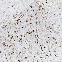 GFAP Mouse Monoclonal Antibody