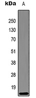 Histone H3 (DiMethyl-K27) Mouse Monoclonal Antibody