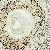 Histone H3 (DiMethyl-K27) Mouse Monoclonal Antibody