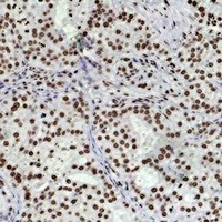 Histone H3 (DiMethyl-K79) Mouse Monoclonal Antibody