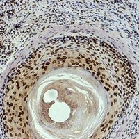 Histone H3 (DiMethyl-K9) Mouse Monoclonal Antibody