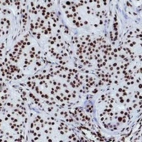 Histone H3 (TriMethyl-K79) Mouse Monoclonal Antibody