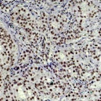 Histone H3 (TriMethyl-K79) Mouse Monoclonal Antibody