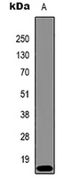Histone H3 (TriMethyl-K9) Mouse Monoclonal Antibody