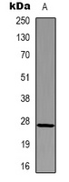 HSP27 Mouse Monoclonal Antibody