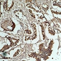 HSP27 Mouse Monoclonal Antibody