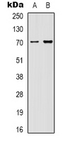 HSP70 Mouse Monoclonal Antibody