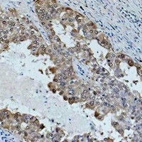 HSP70 Mouse Monoclonal Antibody