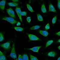 HSP70 Mouse Monoclonal Antibody