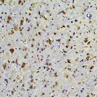 HSP90 beta Mouse Monoclonal Antibody