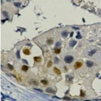 PCNA Mouse Monoclonal Antibody