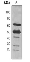 Rubisco Large Chain Mouse Polyclonal Antibody