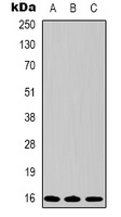 Survivin Mouse Monoclonal Antibody