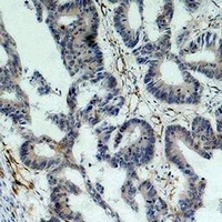 Survivin Mouse Monoclonal Antibody