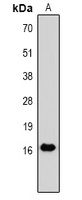 TNF alpha Mouse Monoclonal Antibody