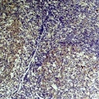 TNF alpha Mouse Monoclonal Antibody