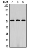 Vimentin Mouse Monoclonal Antibody