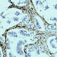Vimentin Mouse Monoclonal Antibody