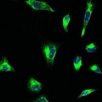Vimentin Mouse Monoclonal Antibody