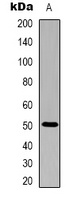 Alliinase Rabbit Polyclonal Antibody