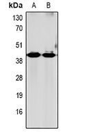 GRPR Rabbit Polyclonal Antibody