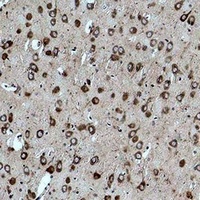 CACNG3 Rabbit Polyclonal Antibody