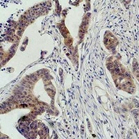 c-RAF Rabbit Polyclonal Antibody