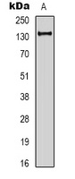 E Cadherin Rabbit Polyclonal Antibody