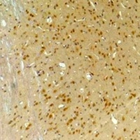 GABRA4 Rabbit Polyclonal Antibody