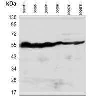 Beta-tubulin Mouse Monoclonal Antibody (HRP)