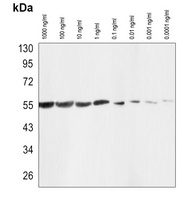 Beta-tubulin Mouse Monoclonal Antibody (HRP)