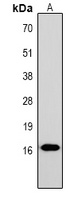Histone H1 (Phospho-T17) Rabbit Polyclonal Antibody