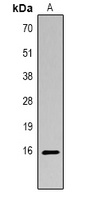 Histone H3 (Acetyl-K14) Rabbit Polyclonal Antibody