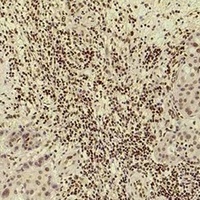 Histone H3 (Acetyl-K14) Rabbit Polyclonal Antibody