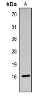Histone H3 (Acetyl-K18) Rabbit Polyclonal Antibody