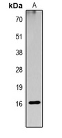 Histone H3 (Acetyl-K23) Rabbit Polyclonal Antibody