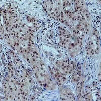 Histone H3 (Acetyl-K23) Rabbit Polyclonal Antibody
