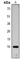 Histone H3 (Acetyl-K27) Rabbit Polyclonal Antibody