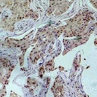 Histone H3 (Acetyl-K27) Rabbit Polyclonal Antibody