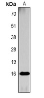 Histone H3 (Acetyl-K36) Rabbit Polyclonal Antibody