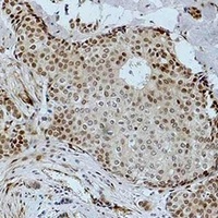 Histone H3 (Acetyl-K36) Rabbit Polyclonal Antibody