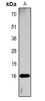 Histone H3 (Acetyl-K4) Rabbit Polyclonal Antibody