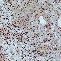 Histone H3 (Acetyl-K4) Rabbit Polyclonal Antibody