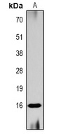 Histone H3 (Acetyl-K56) Rabbit Polyclonal Antibody